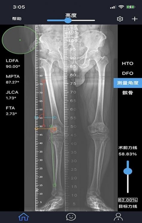 华保膝望